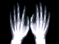 X-Hand